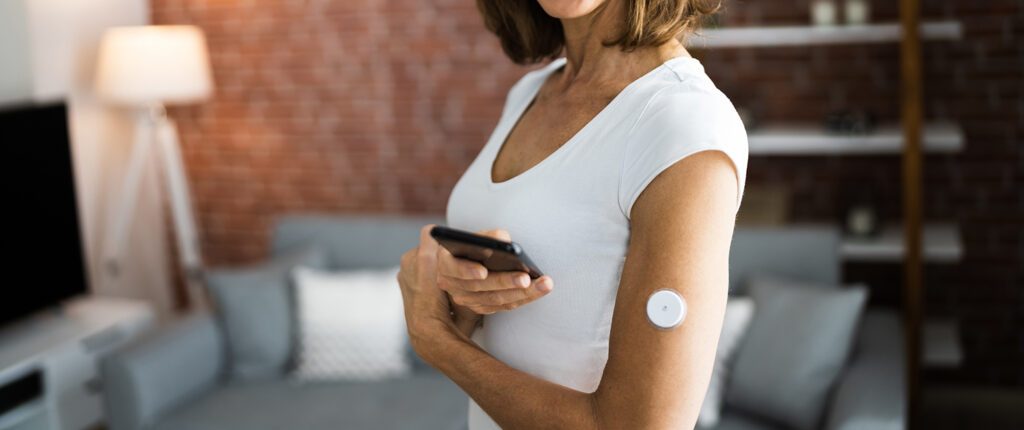 Glucose-Sensor-Messystem (CGM) zur Überwachung des Blutzuckerspiegels bei Diabetes