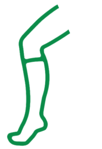 Ein Bein mit einem Stützstrumpf