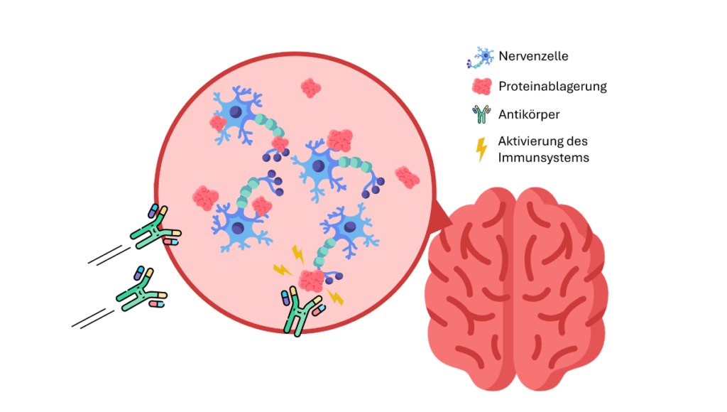 Neue Demenz-Therapie: Illustration von Nervenzellen im Gehirn mit Proteinablagerungen und andockenden Antikörpern