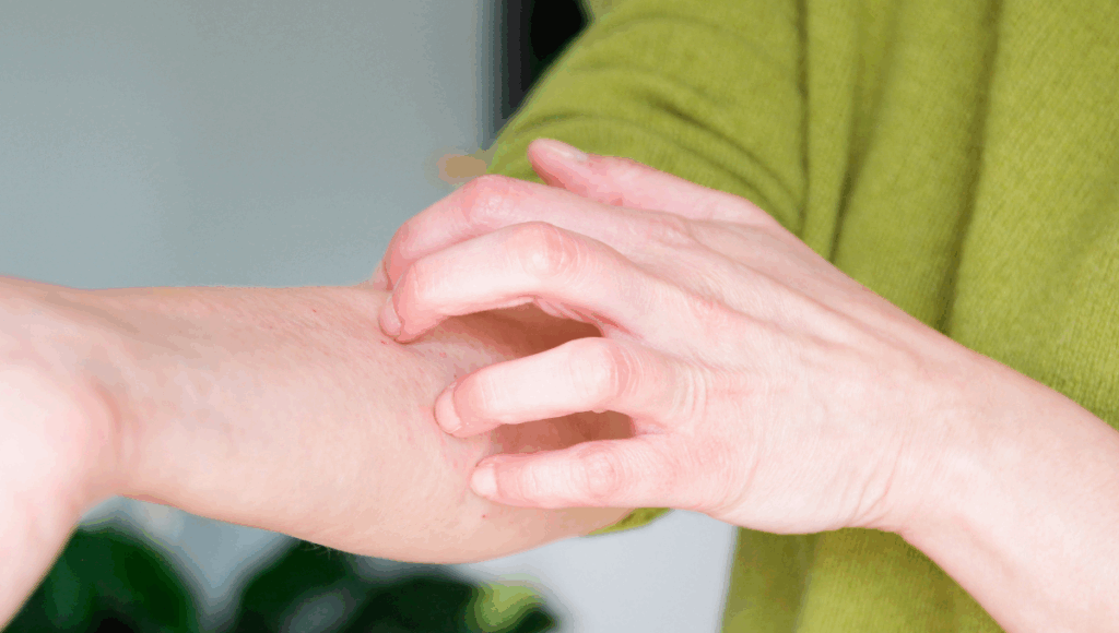 Eine Person juckt sich mit der Hand am Unterarm wegen einer Hautreaktion.